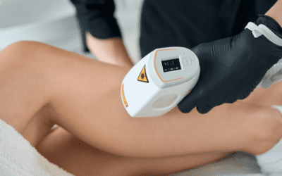 Endermologia LPG Alliance – sposób na jędrne ciało i walkę z cellulitem